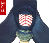 『面内側』染色後